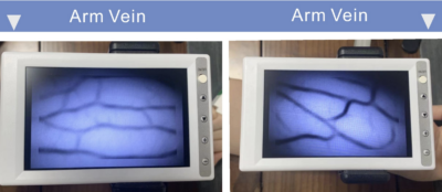 MC401 Vein Finder Easy To Use - Image 3